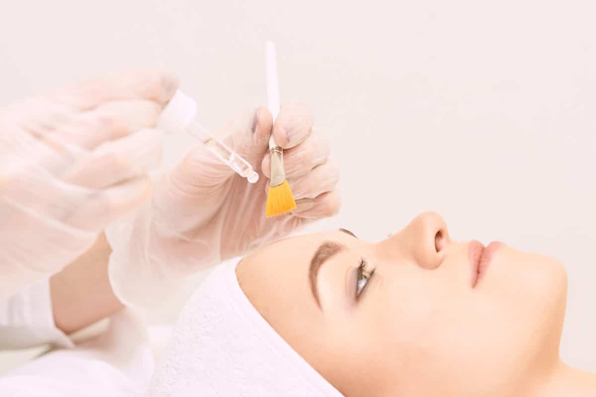 Chemical Peel Oakville