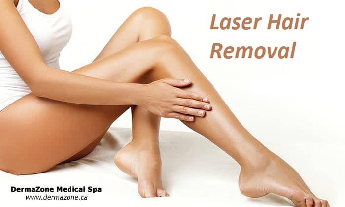 Painless Laser Hair Removal Oakville | DermaZone Medical Spa