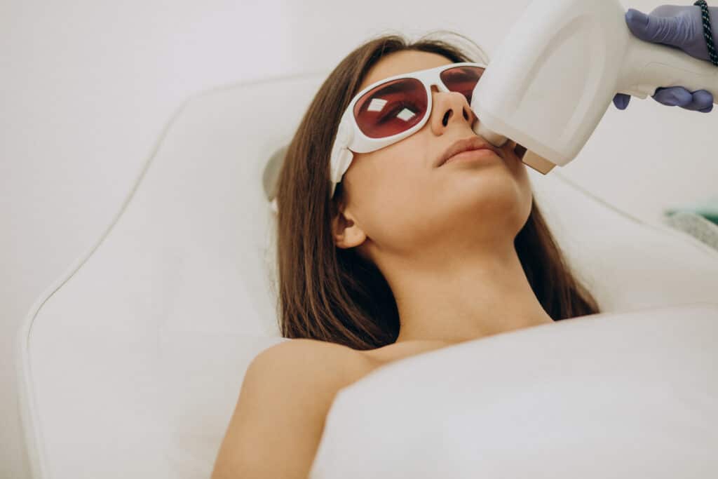 IPL photofacial in Oakville