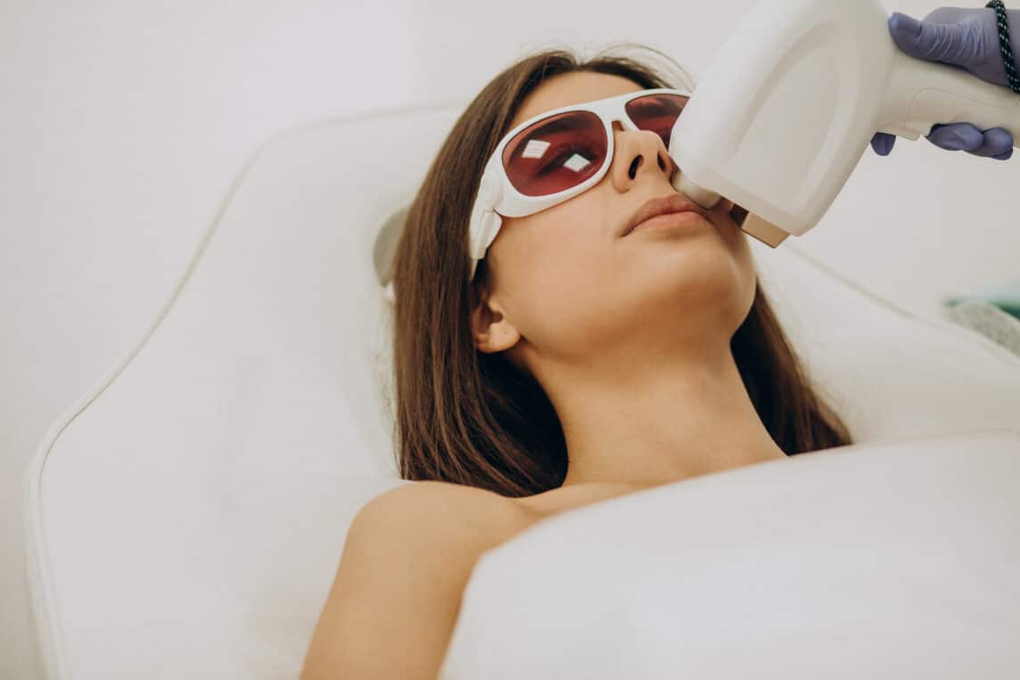 IPL photofacial treatment at DermaZone in Oakville