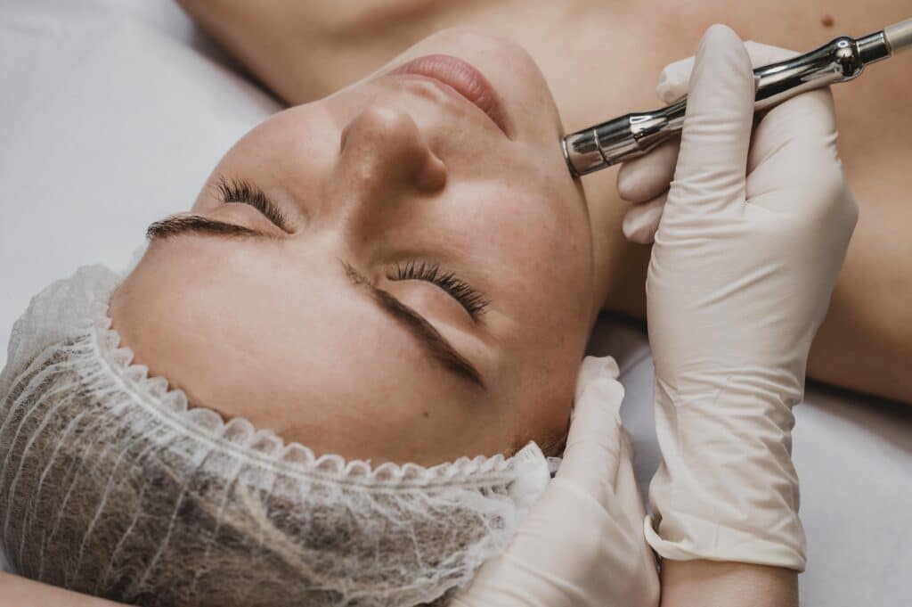 Microneedling in Oakville